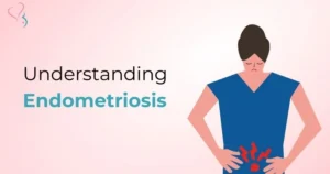 Understanding Endometriosis: Expert Care at Dr. Aayushi Clinic, Dwarka, Delhi